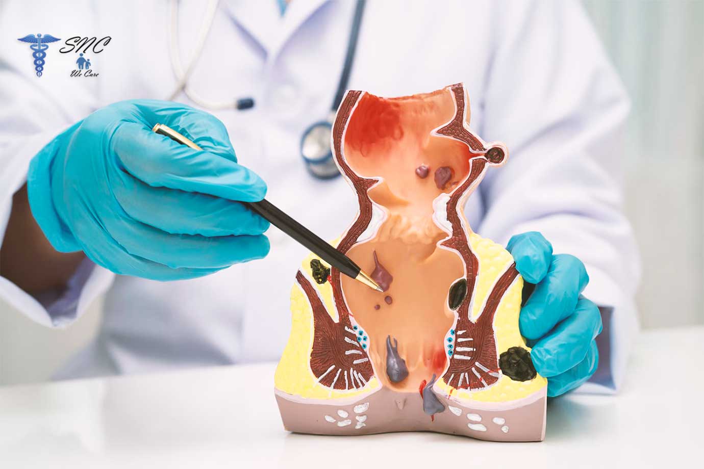 Fissure Fistula Treatment